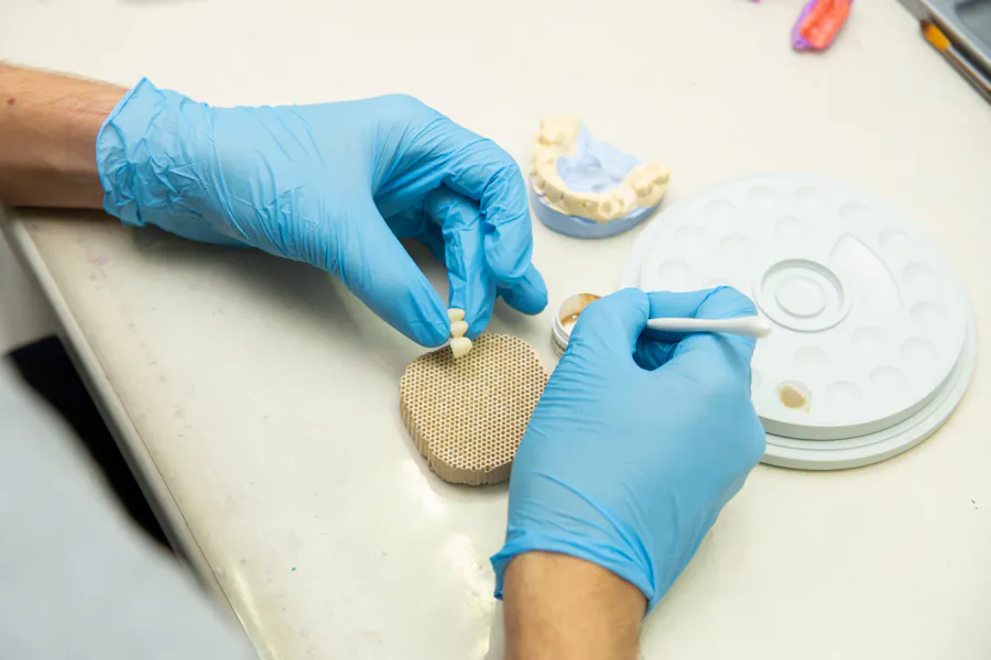 Dentistas Las Palmas de Gran Canaria para implantes dentales y pr&oacute;tesis fija
